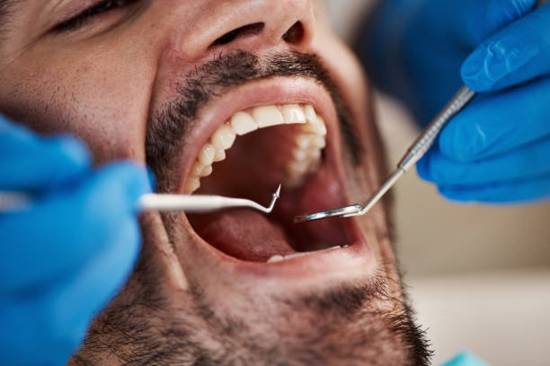 Best Urgent Dental Care for Toothache in Manhattan, NY